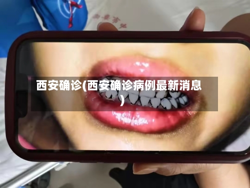 西安确诊(西安确诊病例最新消息)-第2张图片